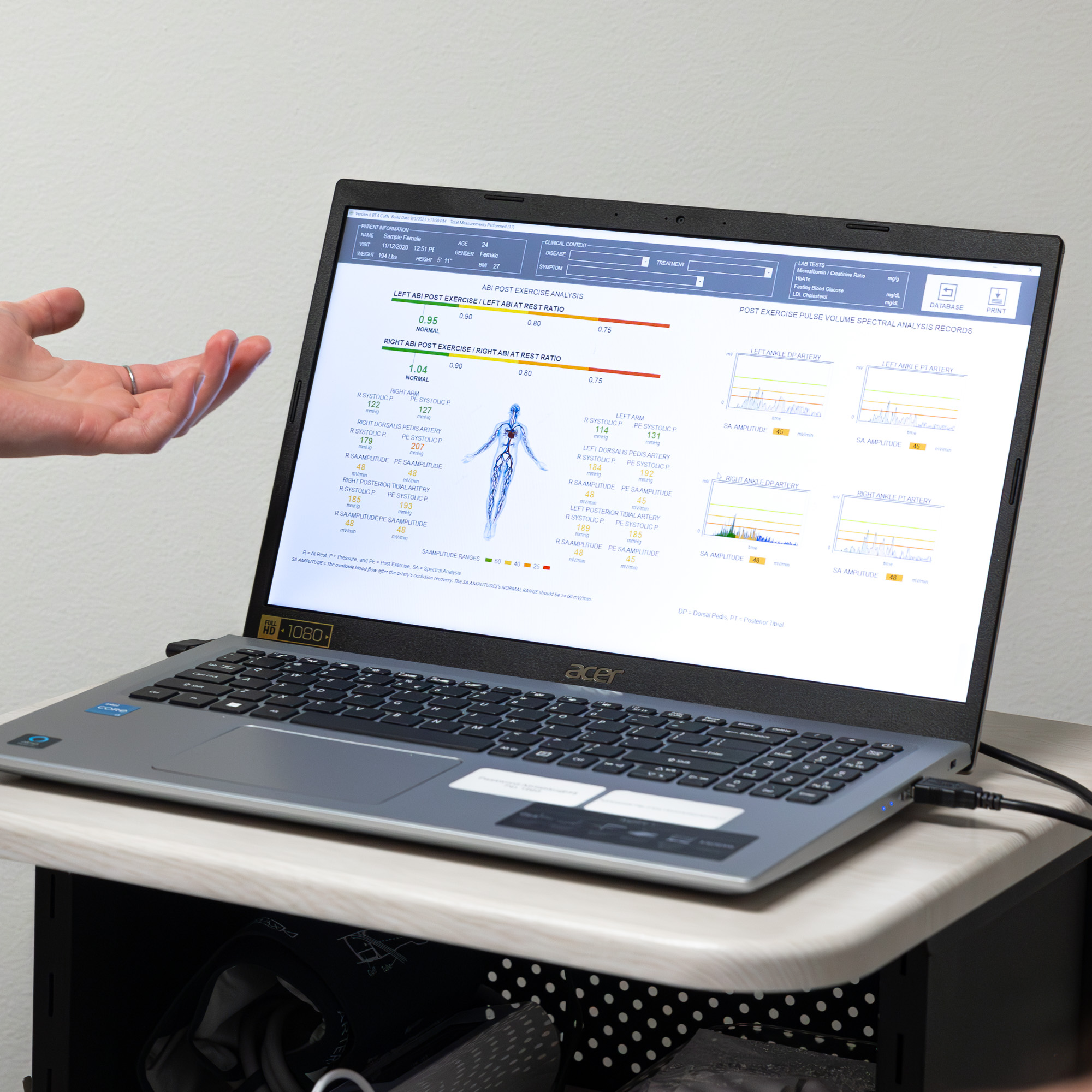 The ANS cardiac testing results screen at E. Michael Health, charting circulation measurements in plain view