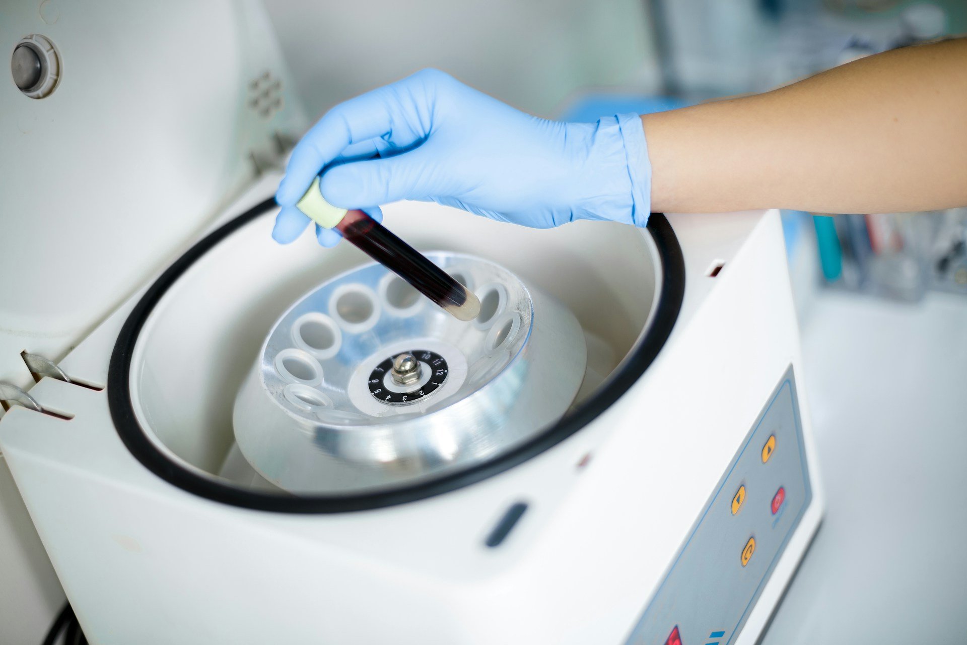 A blood sample being placed into a laboratory centrifuge