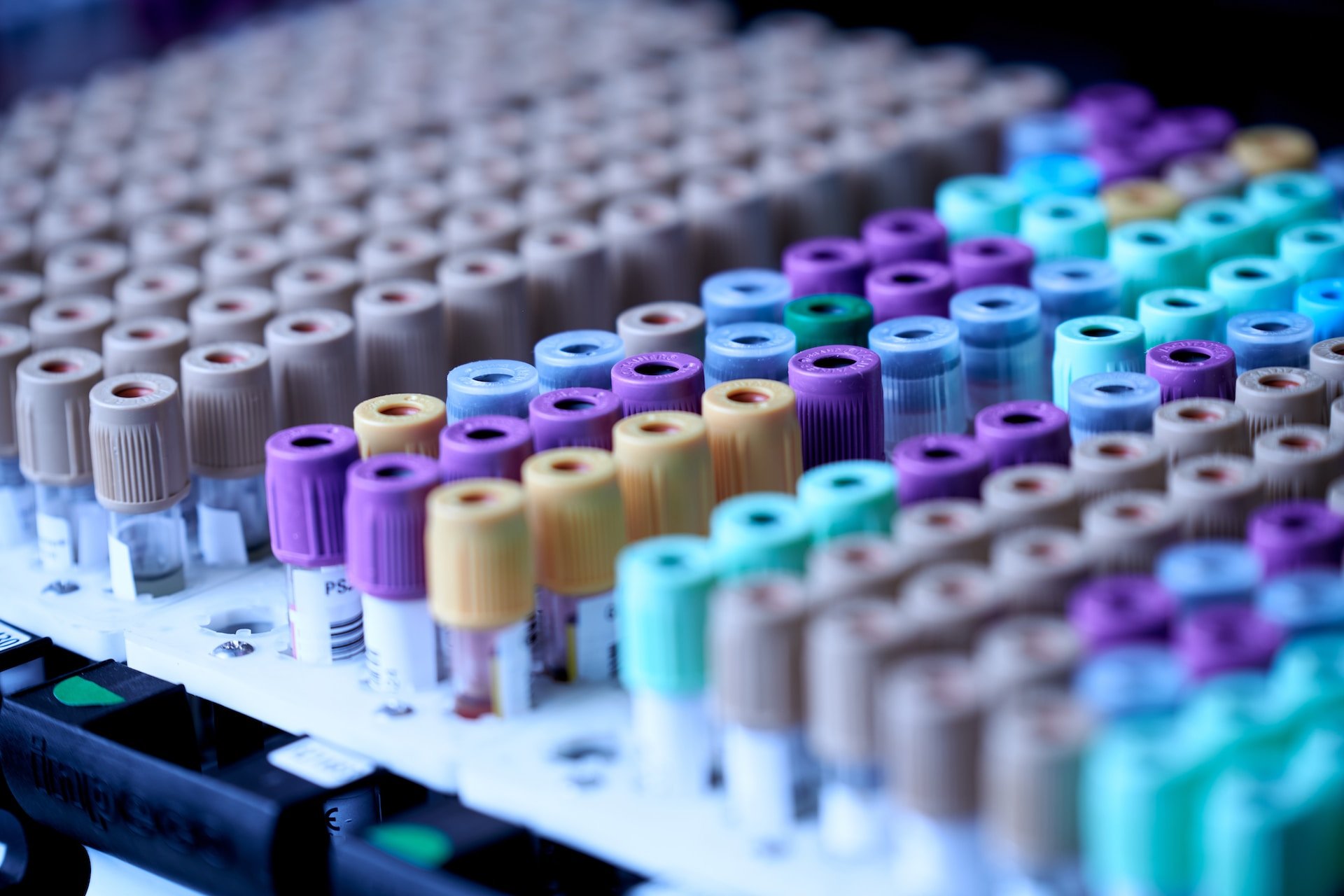 Racks of labeled blood sample vials in a laboratory